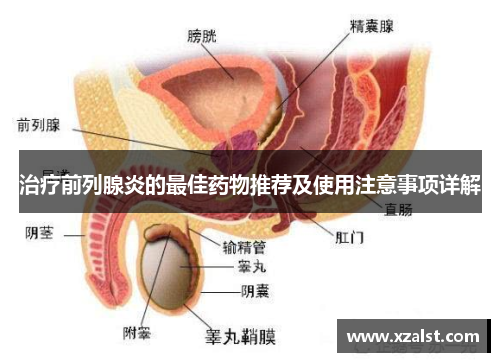 治疗前列腺炎的最佳药物推荐及使用注意事项详解